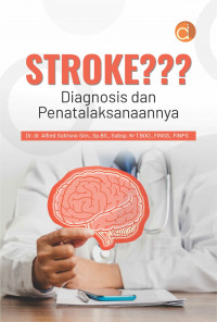 Image of Stroke??? Diagnosis dan Penatalaksanaannya